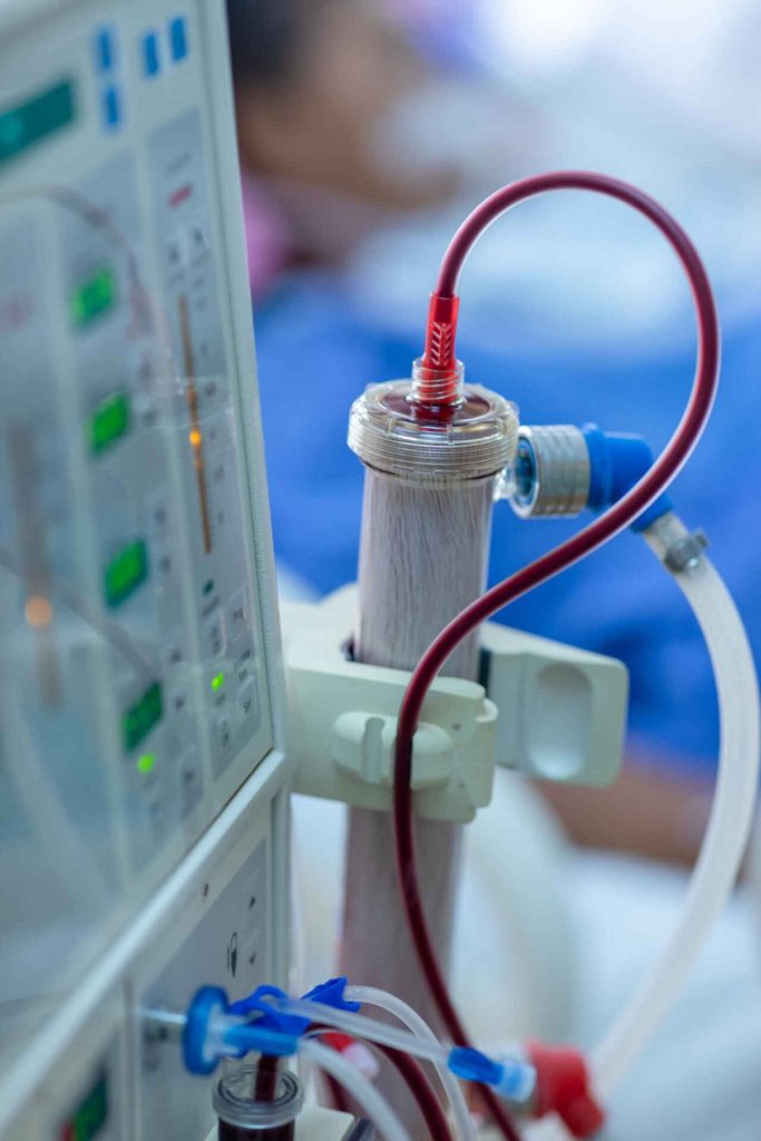 PhilHealth Increases Dialysis Coverage to PHP 1 Million Per Year